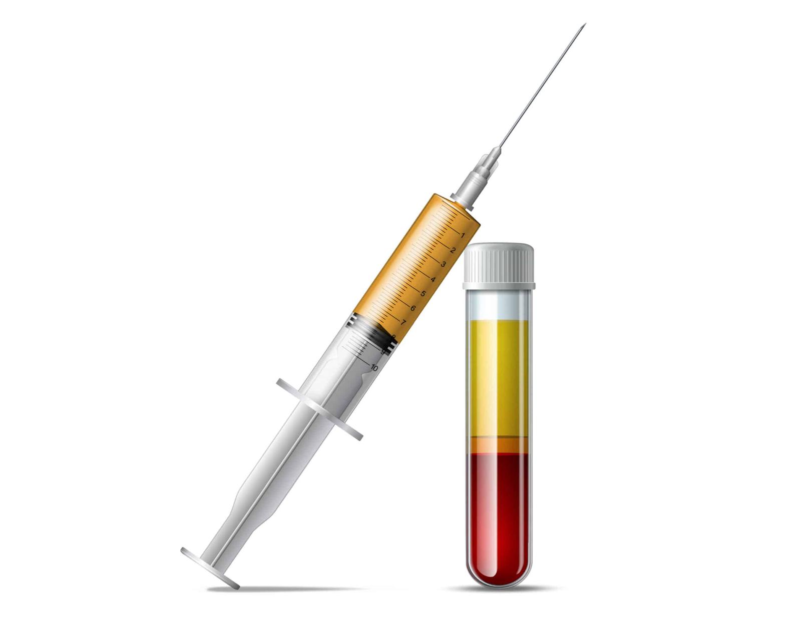 image alopécie médecine