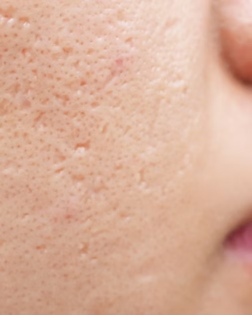 image plasmathérapie médecine anti-âge